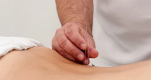 טיפול בפריצת דיסק ללא ניתוח - עודד מכניס מחטים בנקודת הטיפול