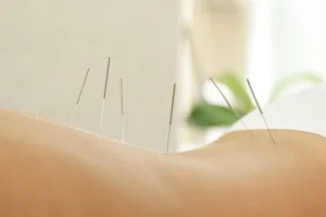 דיקור וטיפול טבעי להפרעות קשב וריכוז